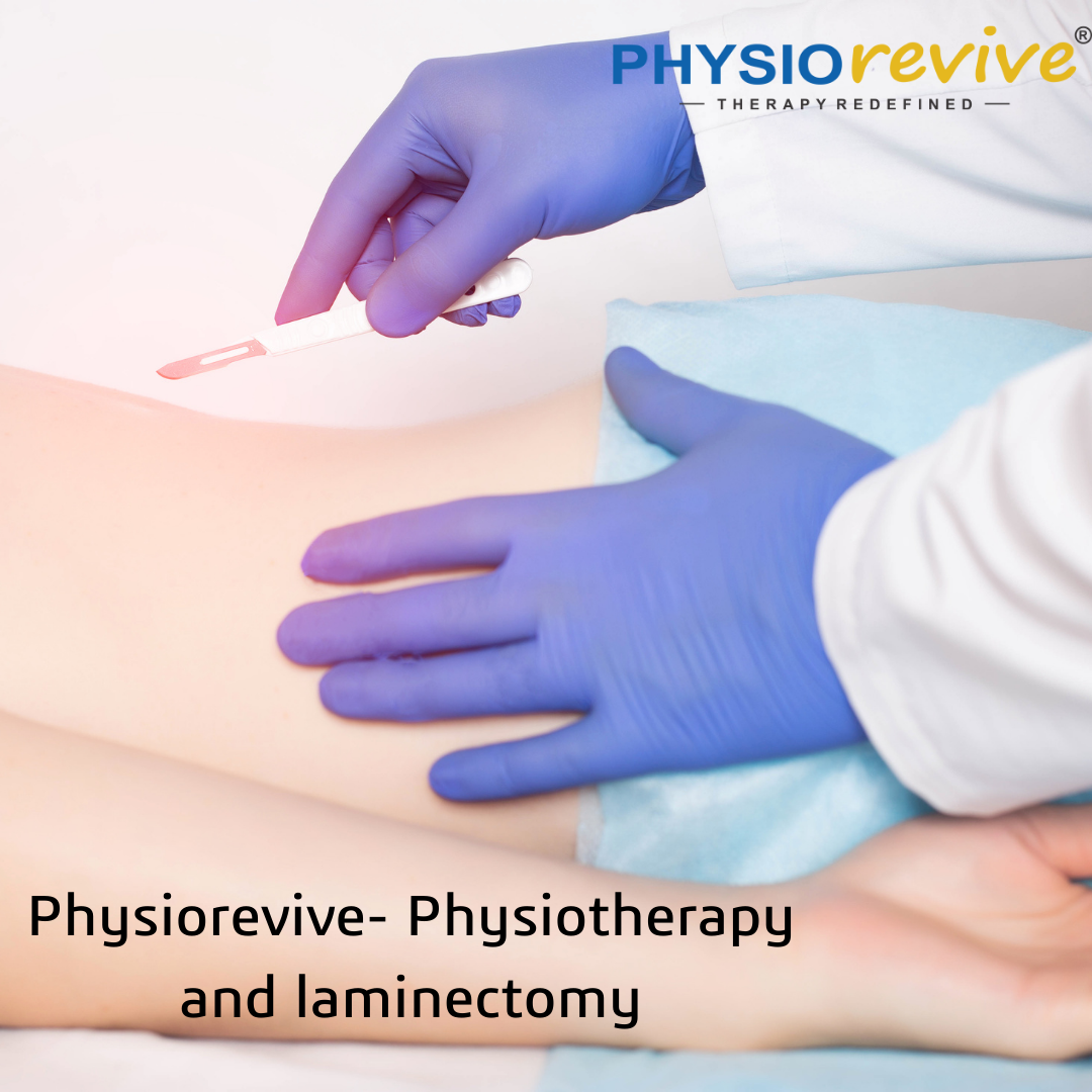 Physiorevive- Physiotherapy and laminectomy - News Samachar